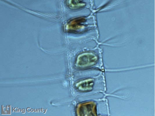 Photo of Chaetoceros diadema